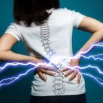 Belde Fıtık Patlaması Nedenleri, Belirtileri ve Tedavi Yöntemleri