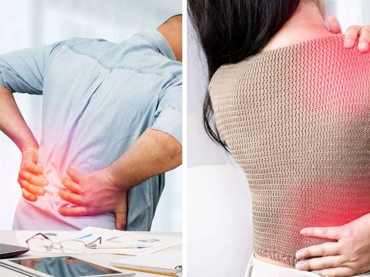 Bel fıtığının zararları nelerdir