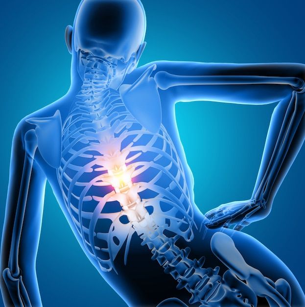 bel fıtığı ve bel kayması